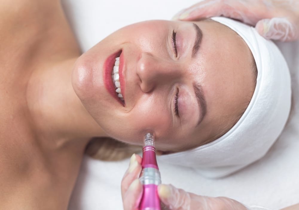How Klarity Treats Acne Scars