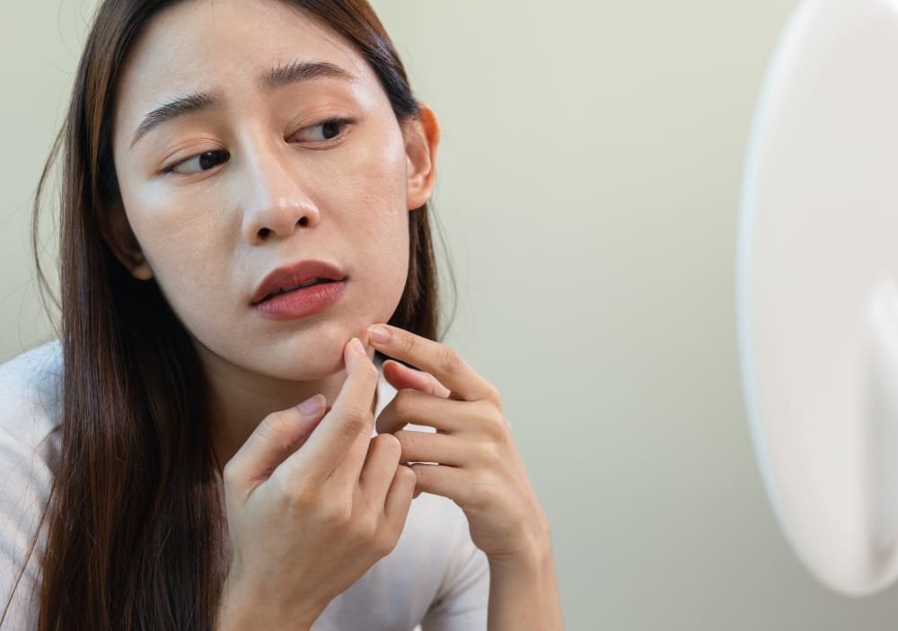 Tips to Prevent Pigmentation