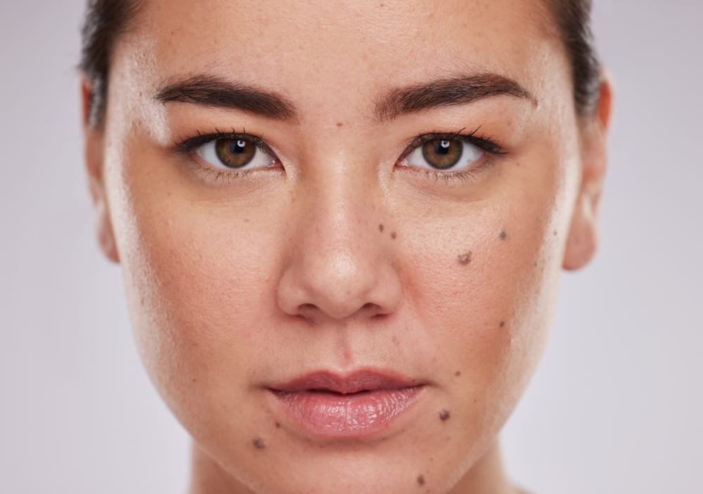 What is Pigmentation?