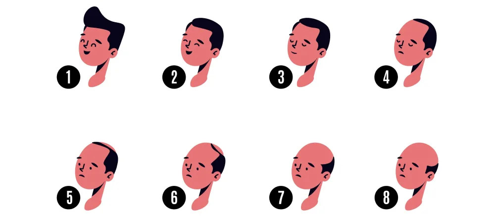 8 stages of hair fall
