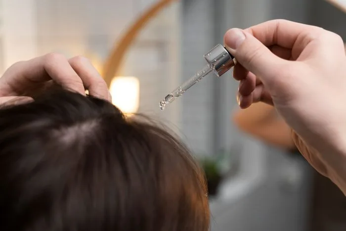 QR678- Hair fall Treatments