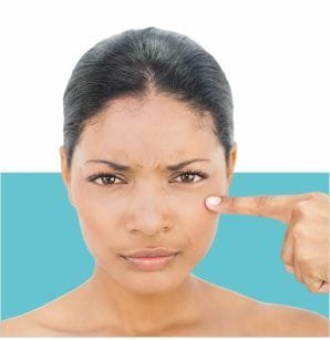 Q-Switch Laser for Skin Rejuvenation