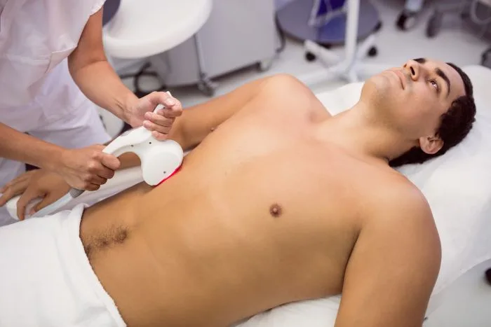 Your Path to Effortless Grooming – Smooth Chest, Back & abdomen Laser Hair Removal for Men in Delhi