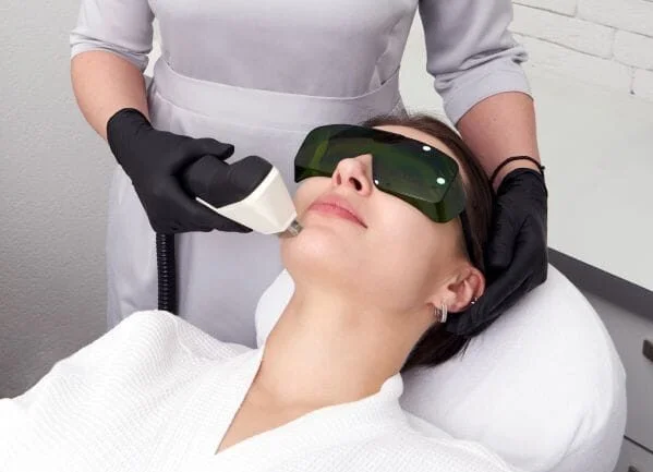 Facial Laser hair removal
