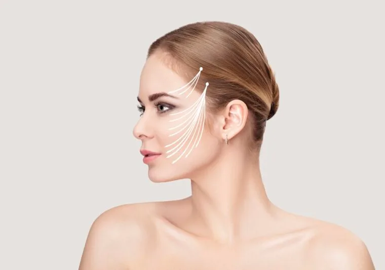 Thread Lift – Instant Lift Without Surgery