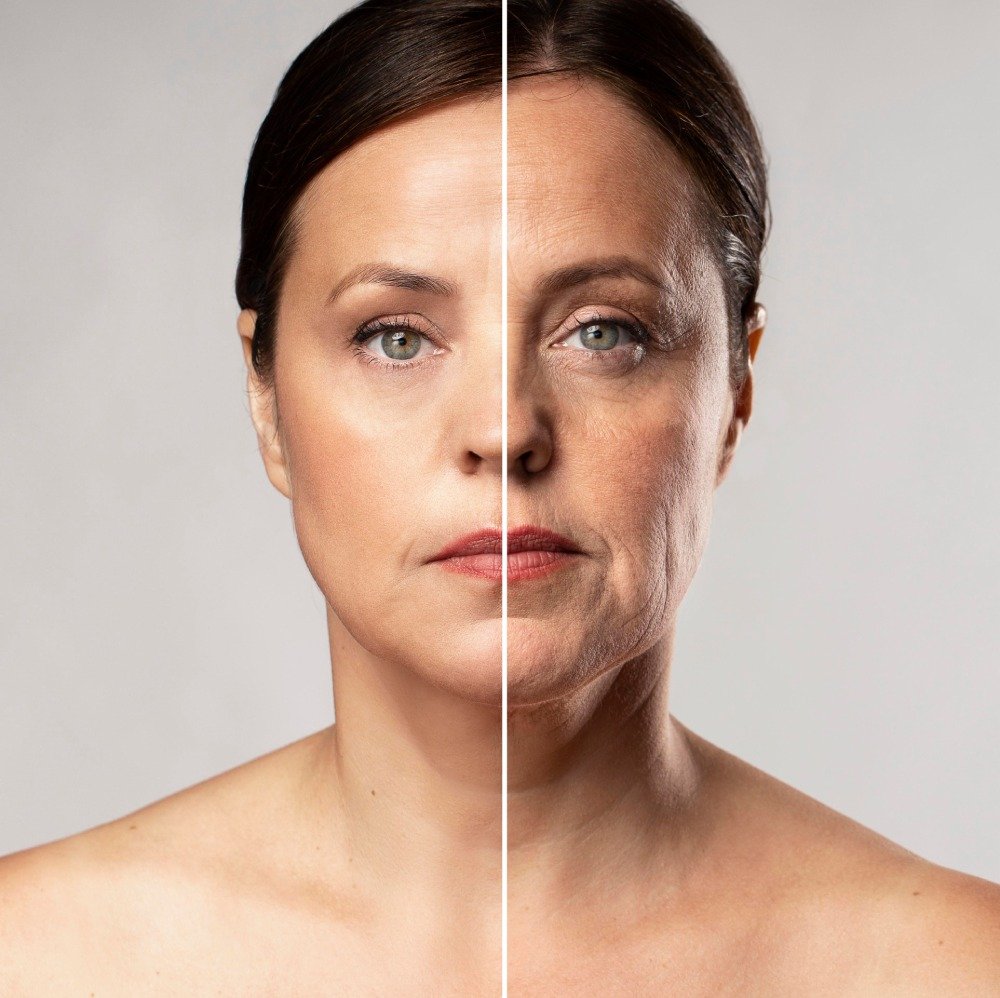 How to Reduce Wrinkles on the Face