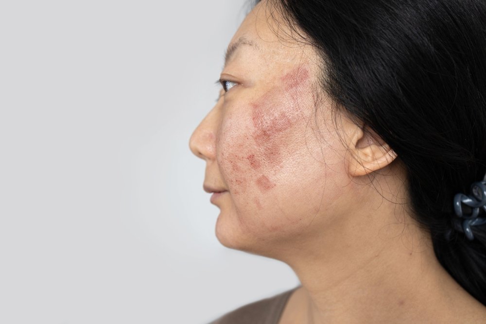 How Delhi Pollution Damages Your Skin