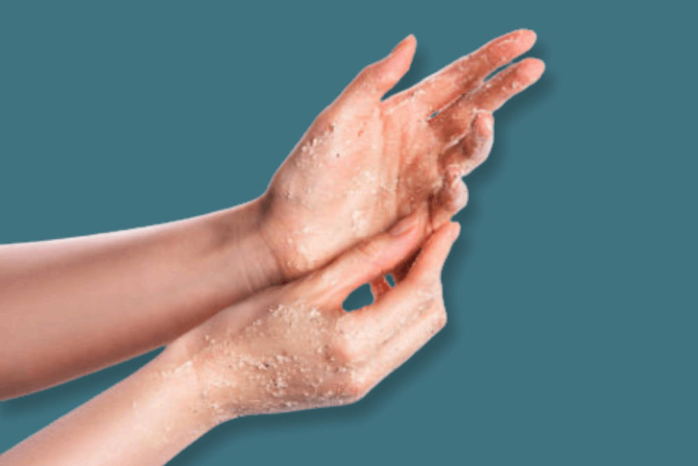 Signs & Symptoms: Is This Really Keratosis Pilaris?